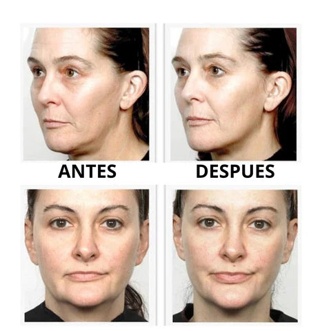 Aura Suprema™ Combo masajeador + serum